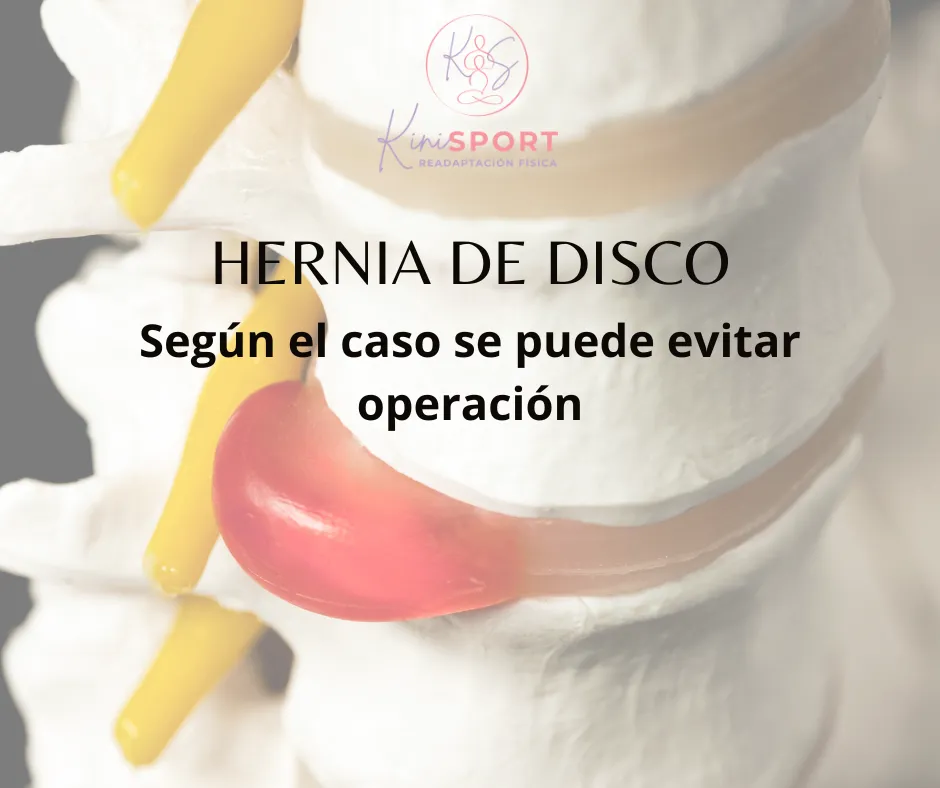 Hernia de disco tratamiento